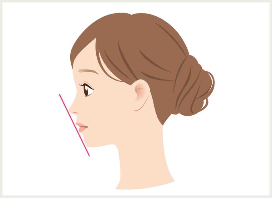 キレイな歯並びとは